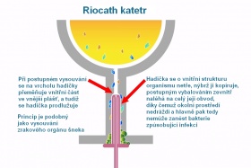 Kliknutím zvětšíte obrázek